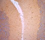 Cofilin 1 Antibody in Immunohistochemistry (Paraffin) (IHC (P))