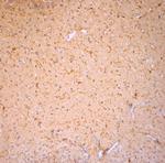 Cofilin 1 Antibody in Immunohistochemistry (Paraffin) (IHC (P))