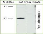 VPS24 Antibody in Western Blot (WB)