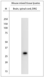 CHMP2A Antibody in Western Blot (WB)