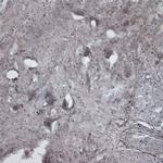 CACNA1I Antibody in Immunohistochemistry - Free Floating (IHC (Free))