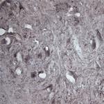 CACNA1I Antibody in Immunohistochemistry - Free Floating (IHC (Free))