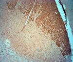 CACNA2D3 Antibody in Immunohistochemistry (Paraffin) (IHC (P))