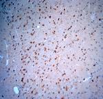 Stargazin Antibody in Immunohistochemistry (Paraffin) (IHC (P))