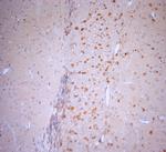 Stargazin Antibody in Immunohistochemistry (Paraffin) (IHC (P))