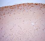 Stargazin Antibody in Immunohistochemistry (Paraffin) (IHC (P))