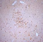 Stargazin Antibody in Immunohistochemistry (Paraffin) (IHC (P))