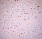 Stargazin Antibody in Immunohistochemistry (Paraffin) (IHC (P))