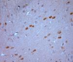 Stargazin Antibody in Immunohistochemistry (Paraffin) (IHC (P))