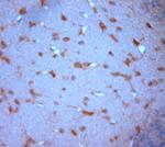 Stargazin Antibody in Immunohistochemistry (Paraffin) (IHC (P))