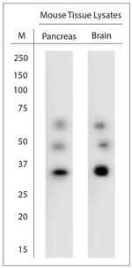 Stargazin Antibody in Western Blot (WB)