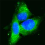 CD36 Antibody in Immunocytochemistry (ICC/IF)