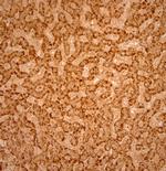 Catalase Antibody in Immunohistochemistry (Paraffin) (IHC (P))