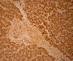 Catalase Antibody in Immunohistochemistry (Paraffin) (IHC (P))