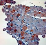 CGRP Antibody in Immunohistochemistry (Paraffin) (IHC (P))