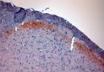 CGRP Antibody in Immunohistochemistry (Paraffin) (IHC (P))