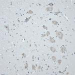 CNTNAP2 Antibody in Immunohistochemistry (Paraffin) (IHC (P))