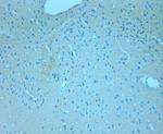 CSP Antibody in Immunohistochemistry (Paraffin) (IHC (P))