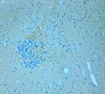 CSP Antibody in Immunohistochemistry (Paraffin) (IHC (P))