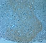 CSP Antibody in Immunohistochemistry (Paraffin) (IHC (P))