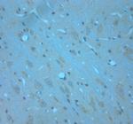 RCAN2 Antibody in Immunohistochemistry (Paraffin) (IHC (P))