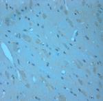 RCAN2 Antibody in Immunohistochemistry (Paraffin) (IHC (P))