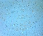 RCAN2 Antibody in Immunohistochemistry (Paraffin) (IHC (P))