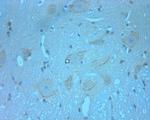 RCAN2 Antibody in Immunohistochemistry (Paraffin) (IHC (P))