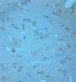 RCAN2 Antibody in Immunohistochemistry (Paraffin) (IHC (P))