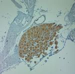 Clavesin 1 Antibody in Immunohistochemistry (Paraffin) (IHC (P))