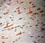 CACNA2D1 Antibody in Immunohistochemistry (Paraffin) (IHC (P))