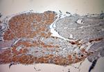 CACNA2D1 Antibody in Immunohistochemistry (Paraffin) (IHC (P))