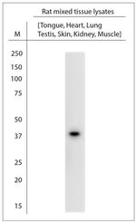 CAHM1 Antibody in Western Blot (WB)