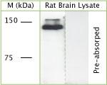 DCTN1 Antibody in Western Blot (WB)