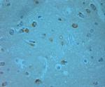 Phospho-ERK1/2 (Thr202, Tyr204) Antibody in Immunohistochemistry (Paraffin) (IHC (P))