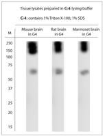 SLC1A2 Antibody in Western Blot (WB)