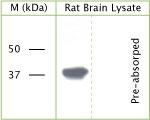 Phospho-GAP43 (Ser41) Antibody in Western Blot (WB)