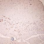 GLUR6 Antibody in Immunohistochemistry (Paraffin) (IHC (P))