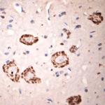 GLUR6 Antibody in Immunohistochemistry (Paraffin) (IHC (P))