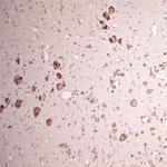 GLUR6 Antibody in Immunohistochemistry (Paraffin) (IHC (P))