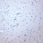 GRIK5 Antibody in Immunohistochemistry (Paraffin) (IHC (P))