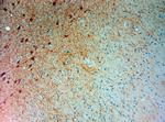 GFAP Antibody in Immunohistochemistry (Paraffin) (IHC (P))