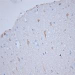 HPCA Antibody in Immunohistochemistry (Paraffin) (IHC (P))