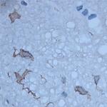 HPCA Antibody in Immunohistochemistry (Paraffin) (IHC (P))