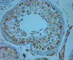 KCNJ13 Antibody in Immunohistochemistry (Paraffin) (IHC (P))