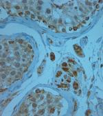 KCNJ13 Antibody in Immunohistochemistry (Paraffin) (IHC (P))