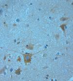 KCNJ13 Antibody in Immunohistochemistry (Paraffin) (IHC (P))