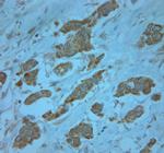 KCNJ13 Antibody in Immunohistochemistry (Paraffin) (IHC (P))