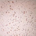 Lamp1 Antibody in Immunohistochemistry (Paraffin) (IHC (P))