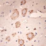 Lamp1 Antibody in Immunohistochemistry (Paraffin) (IHC (P))